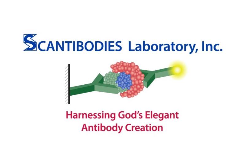 Scantibodies Laboratory